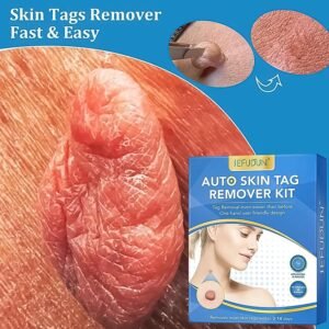 Skin Tag Remover Kit 2-in-1 – Painless Home Use | Arrive Kit