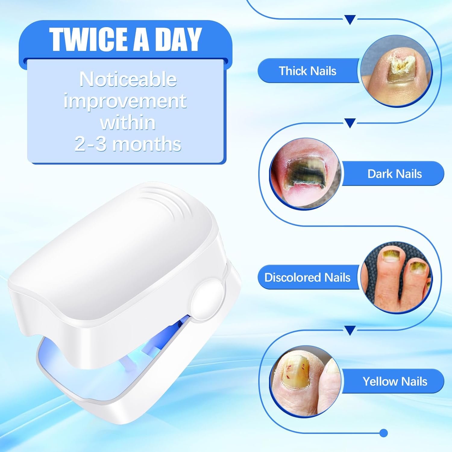 Nail Fungus Laser Treatment – Rechargeable Device for Hands & Feet | AuriGlam