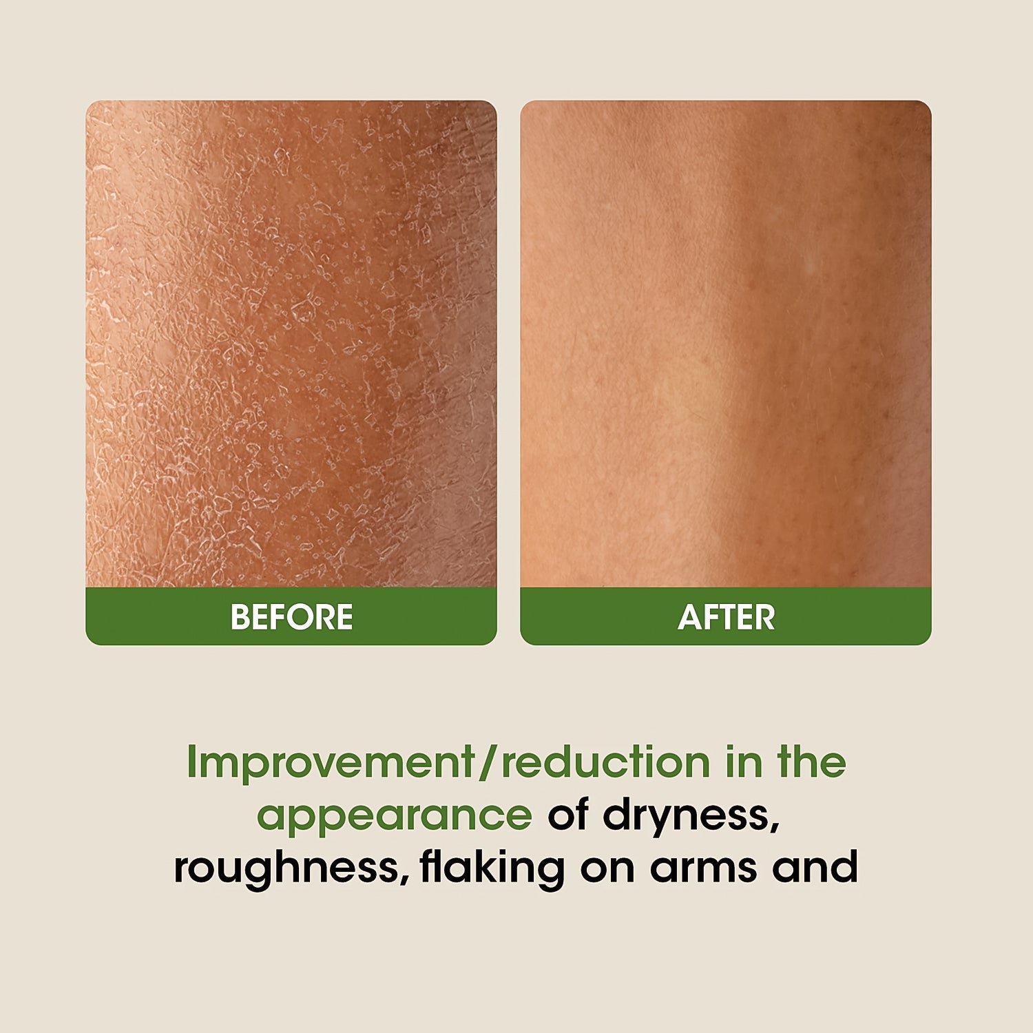 Aloe Vera Body Lotion with SPF 30 – Hydrating & Sun Protecting 350ML