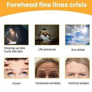 Forehead Wrinkle Patches (10 Pcs) – Anti-Aging Pads | GlowForm