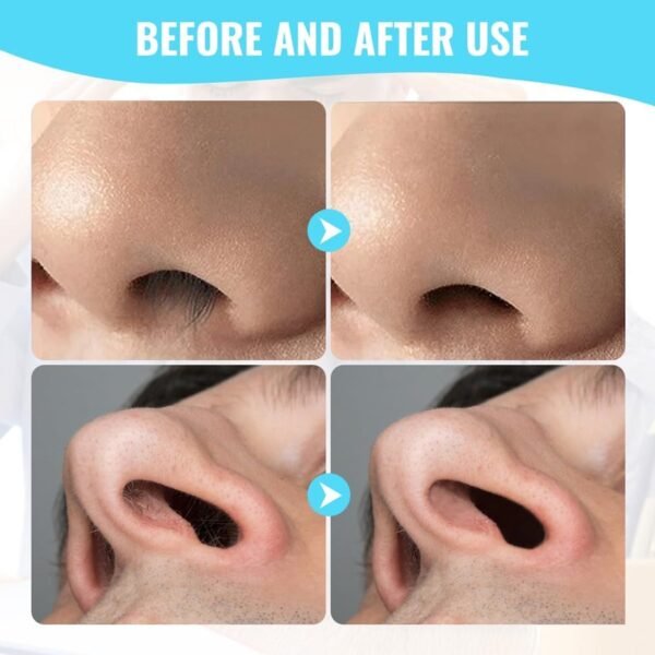 Nose Hair Trimmer – Painless 3-in-1 Grooming Kit | PureBeard