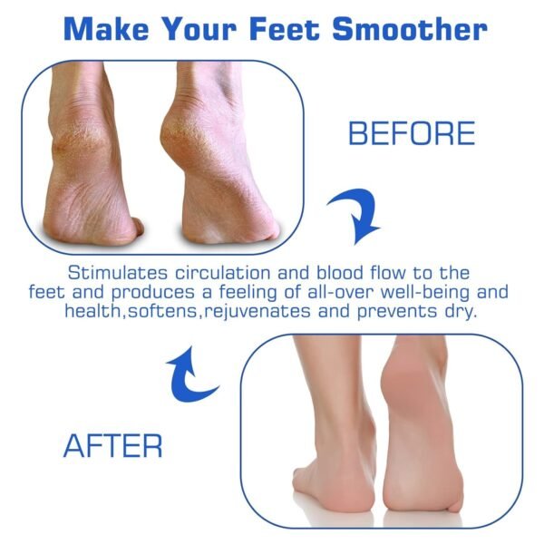 Silicone Foot Scrubber Mat – Soft Bristles for Easy Foot Care