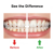 Water Flosser – Portable Smart Device for Gum Health | Velvet Wipe
