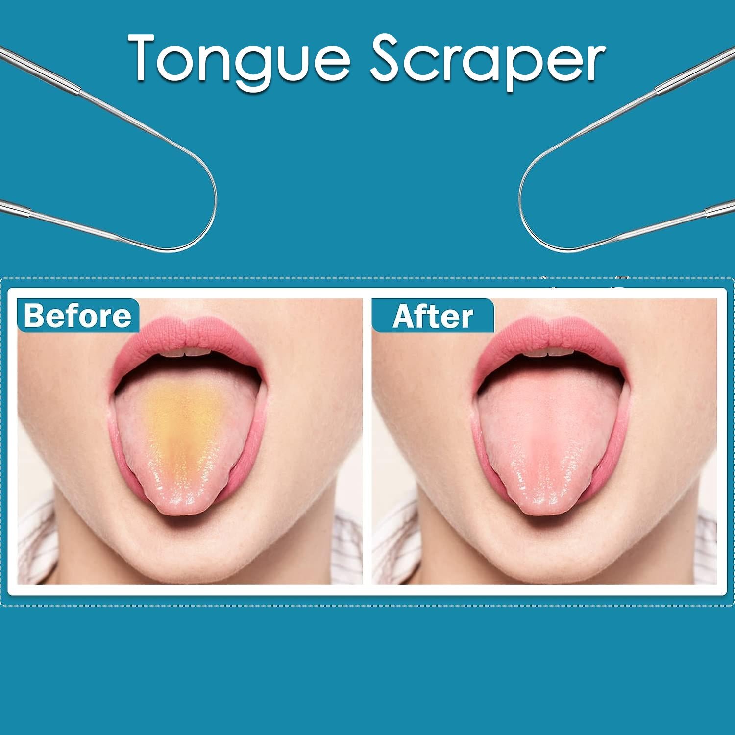Tongue Cleaner – Fresh Breath & Oral Hygiene for All | MintGuard