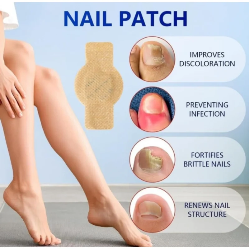 PID-66776-Fungal-Nail-Patches-Yellow-6-1000×1000-1.webp