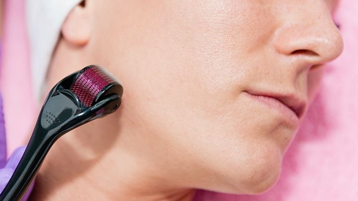 Derma Roller – Anti-Ageing, Scar Removal & Hair Regrowth | Calm & Curl